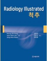 Radiology Illustrated: 척추 (한국어판) _세종의학