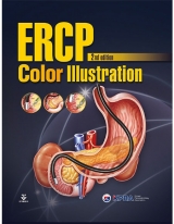ERCP Color Illustration 2e