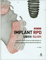 임플란트 국소의치 (Implant RPD) _군자출판사